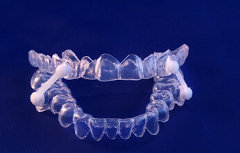close-up of oral appliance for sleep apenar in san ramon, ca 